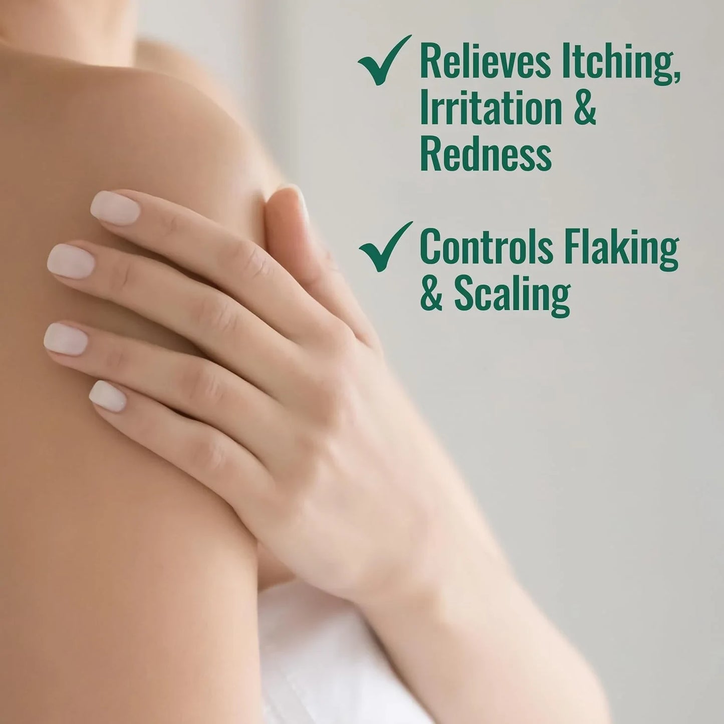 Nizoral Psoriasis Relief Cream- Relieves Itching, Irritation & Redness and Controls Flaking and Scaling with Maximum Strength Medicine (Salicylic Acid 3%), 4 Fl Oz - USA in UK