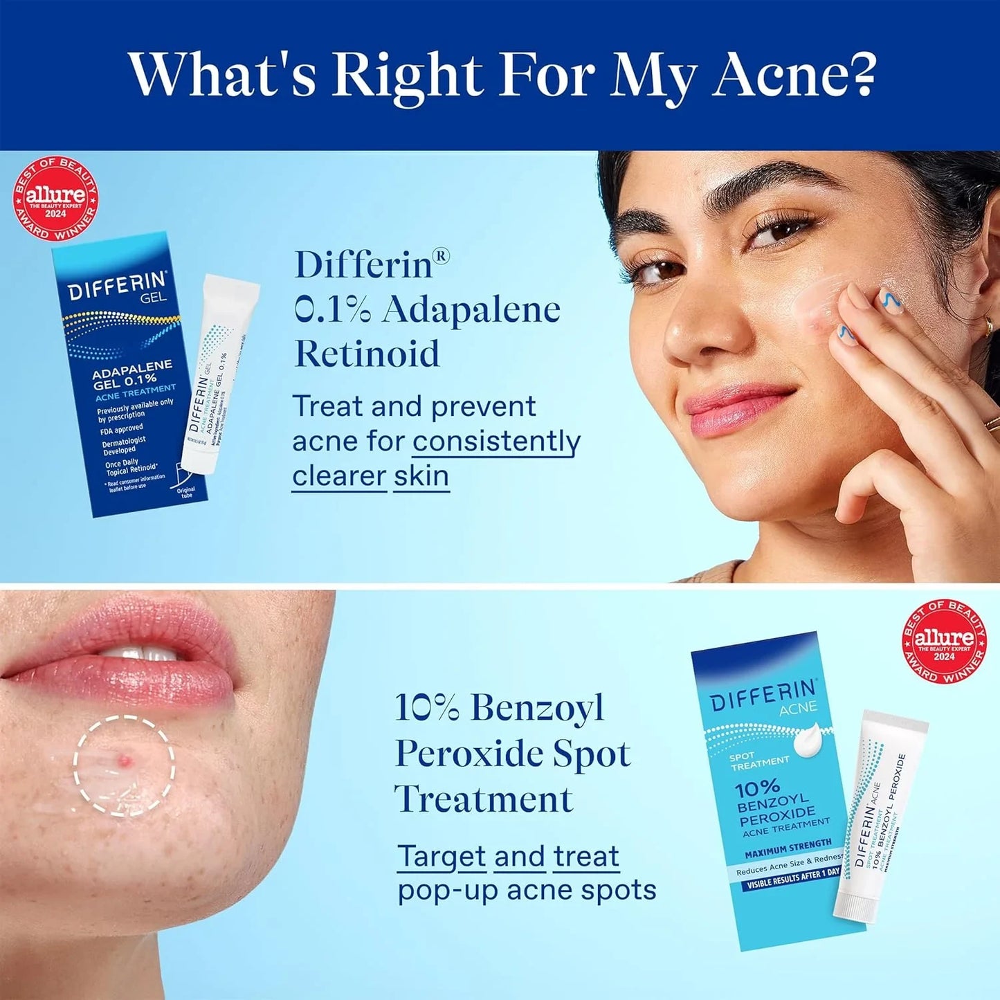 Differin Acne Spot Treatment with 10% Benzoyl Peroxide, Maximum Strength OTC Acne Treatment, Fast Acting Spot Treatment for Face, 1 Oz - USA in UK