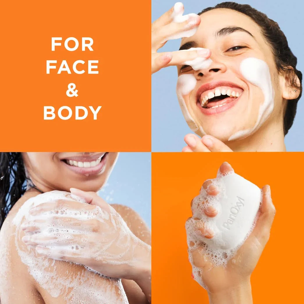 PanOxyl Acne Treatment Bar with 10% Benzoyl Peroxide, Maximum Strength Acne Bar Soap for Face, Chest and Back, Benzoyl Peroxide Bar Soap Body Wash, Vegan, for Acne Prone Skin, 4 Oz - USA in UK