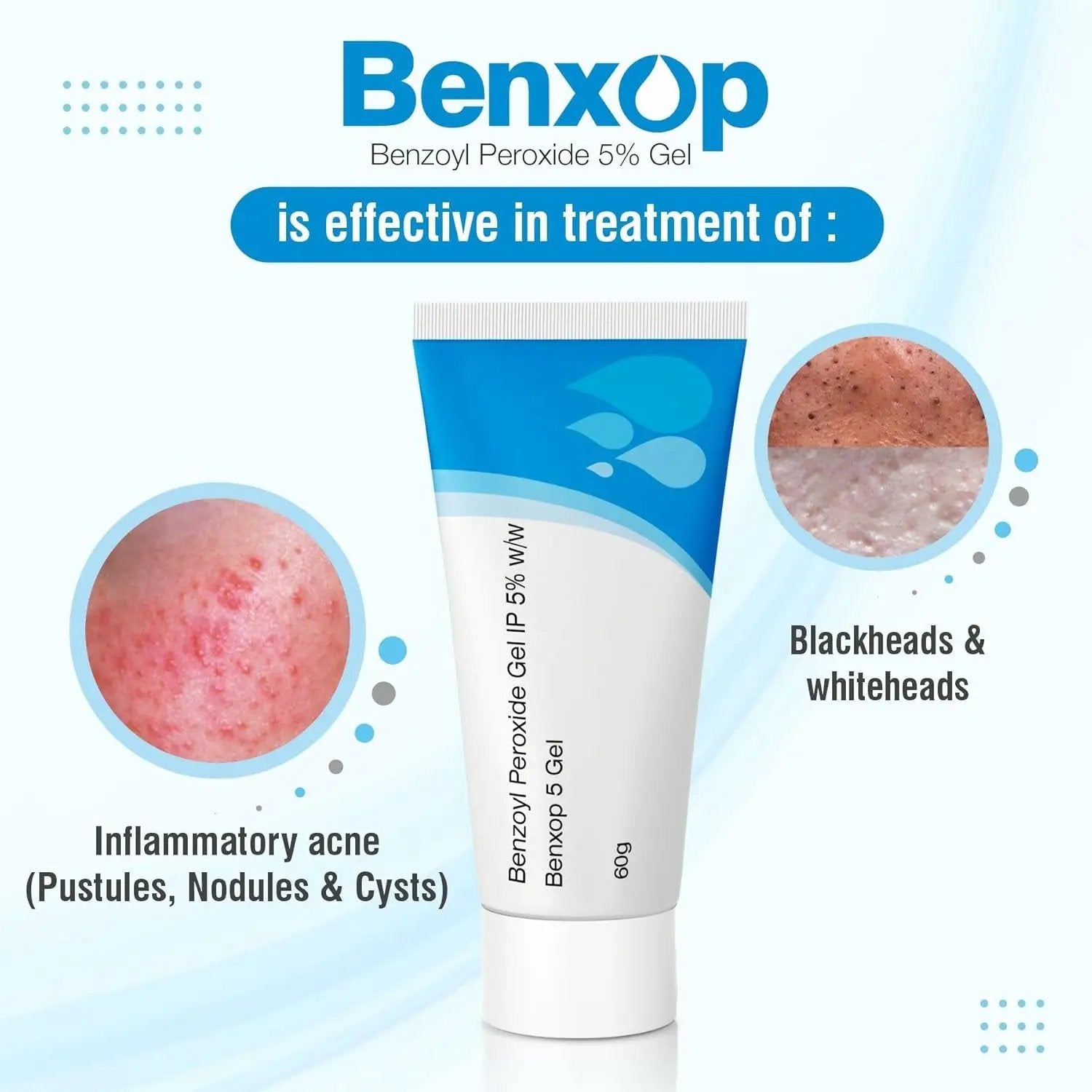 Salve Benxop Benzoyl Peroxide 5% Gel for Pimples, Acne - 60 Gm / 2.11 Oz