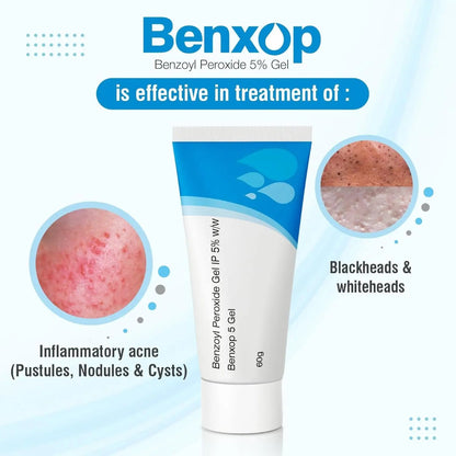 Salve Benxop Benzoyl Peroxide 5% Gel for Pimples, Acne - 60 Gm / 2.11 Oz