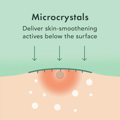 Rael Miracle Pimple Patches, Microcrystal Spot Cover, 9 Count - view 4