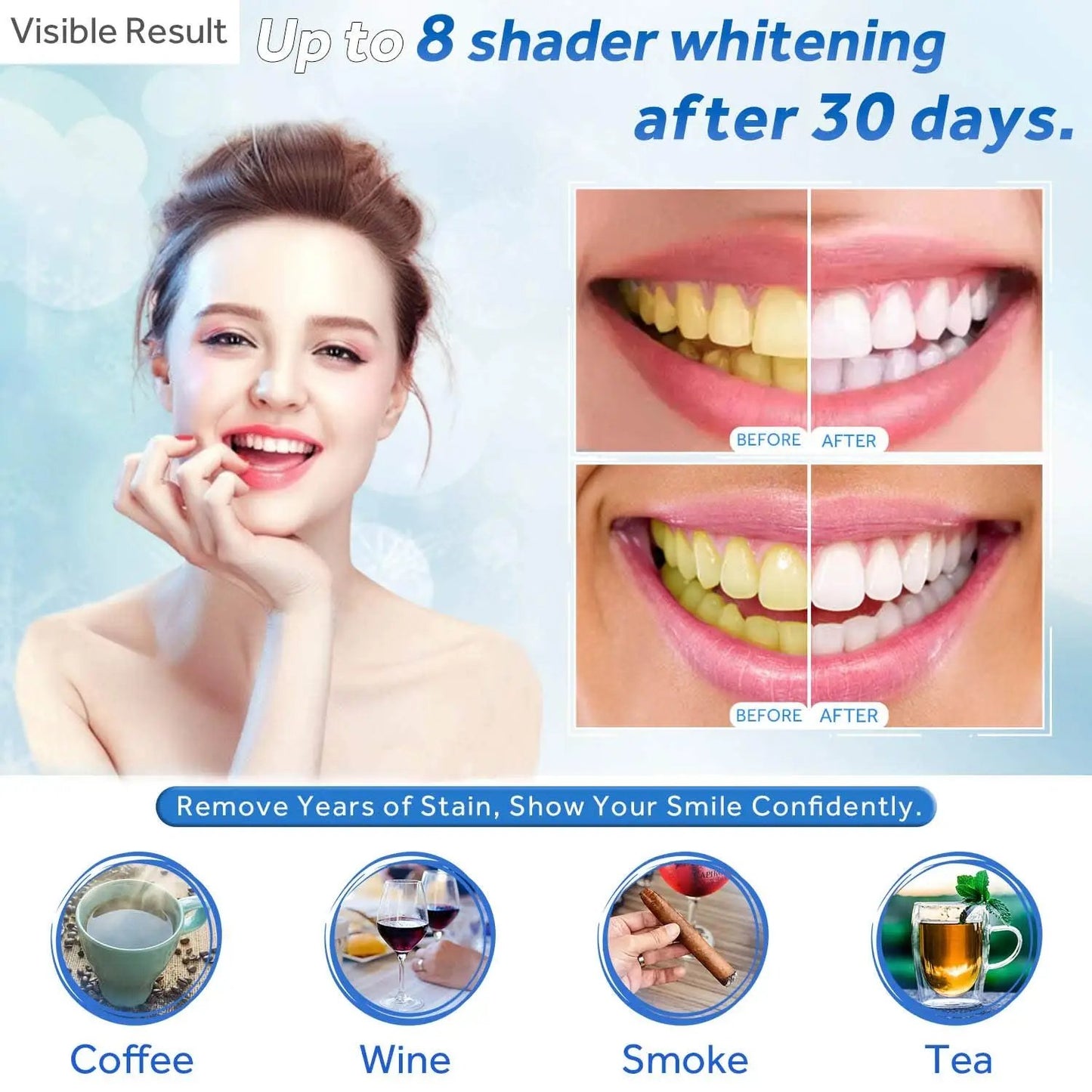 EZGO 10 Pack Teeth Whitening Gel Refills 22% Bleaching Gel, No Sensitive Teeth Whitener, Great for Sensitive Tooth Whitening, Carbamide Peroxide Teeth Whitening Gel, Mint Flavor (10X 5ML)