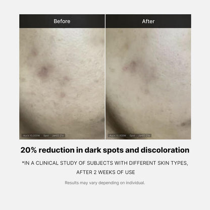 Medicube Deep Vita C Serum 2.0 with 14.5% Vitamin C - view 4