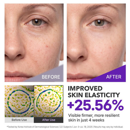 Centellian 24 Expert Madeca Cream Active Renew PDRN - view 3