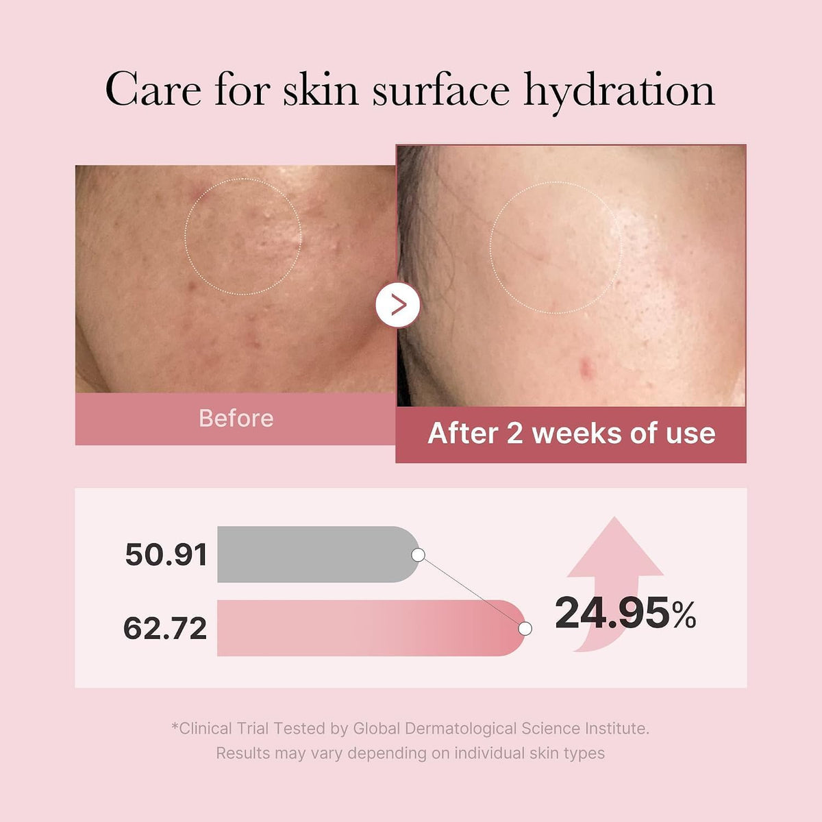 medicube Salmon DNA PDRN Pink Glutathione Spray Serum 3.38 fl oz — alternate product view