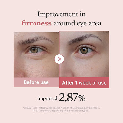 medicube Eye Serum with Salmon DNA PDRN and Pink Peptides - view 4