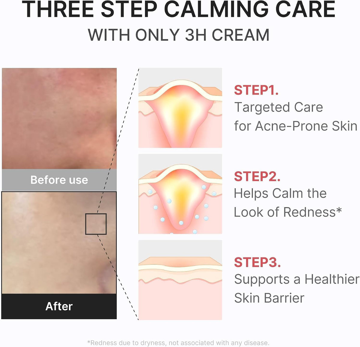 medicube 3H Daily Relief Cream - view 4