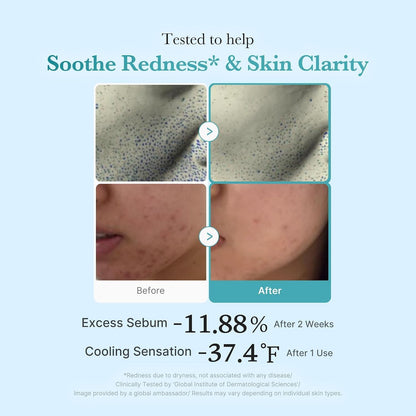 Medicube Azelaic Acid Niacinamide Clarifying Toner - view 4
