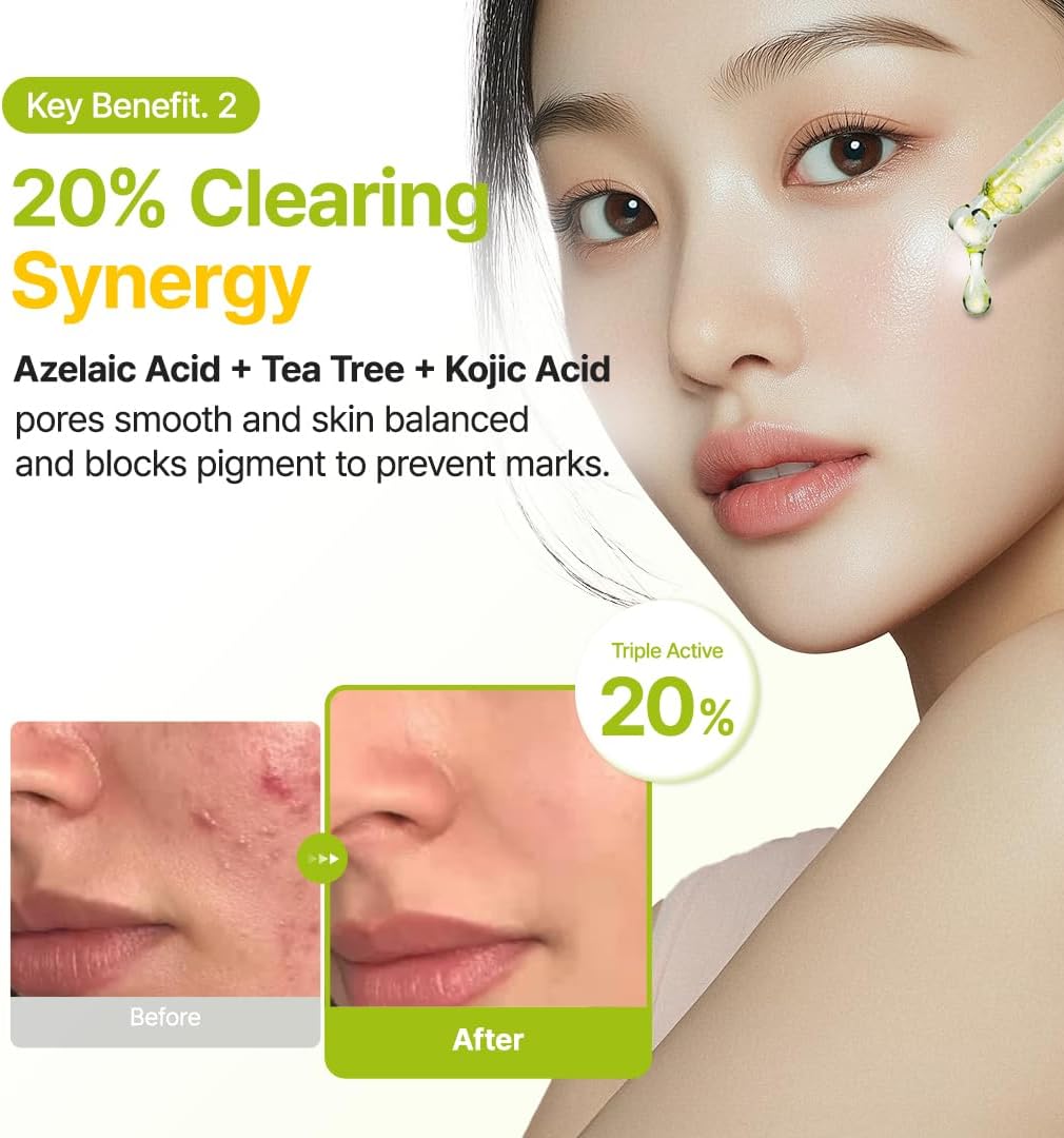 Purito Azelaic 10% Kojic Serum for Sensitive Skin 30 ml - view 6