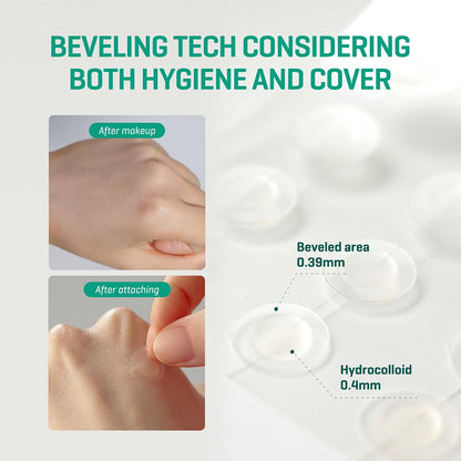 SOME BY MI 30 Days Miracle Clear Spot Patch - 18 Patches in 2 Sizes - view 6