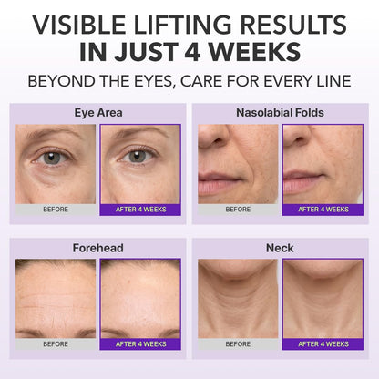 Centellian 24 360 Shot PDRN Firming Eye Cream - view 3