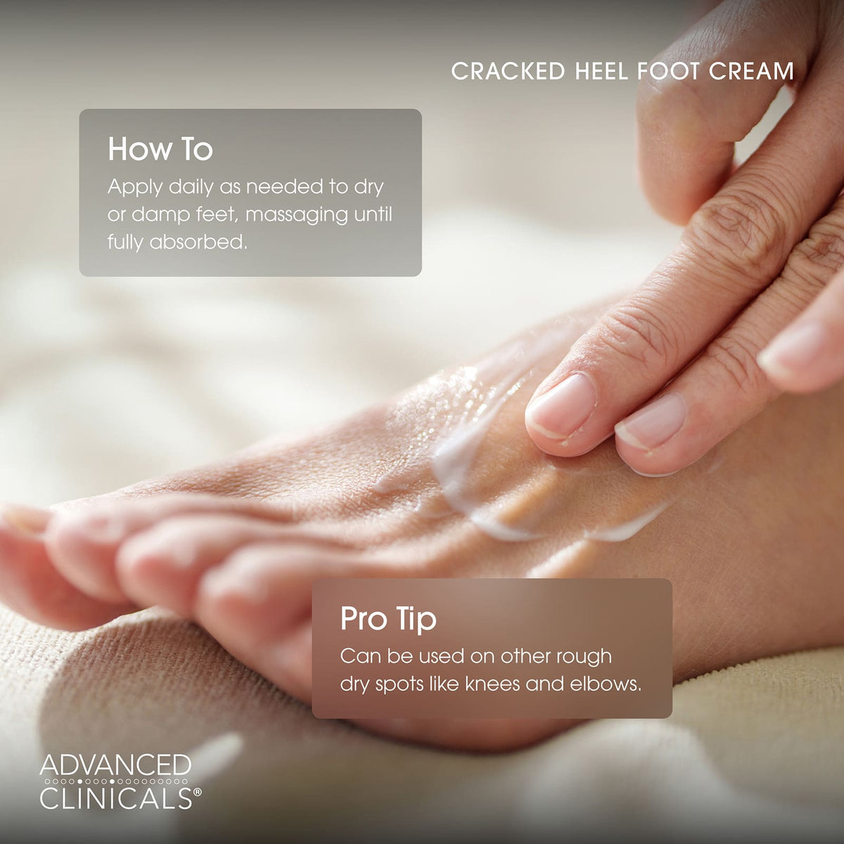 Advanced Clinicals Cracked Heel Rough Spot Cream 237 ml (8 fl oz) - view 4