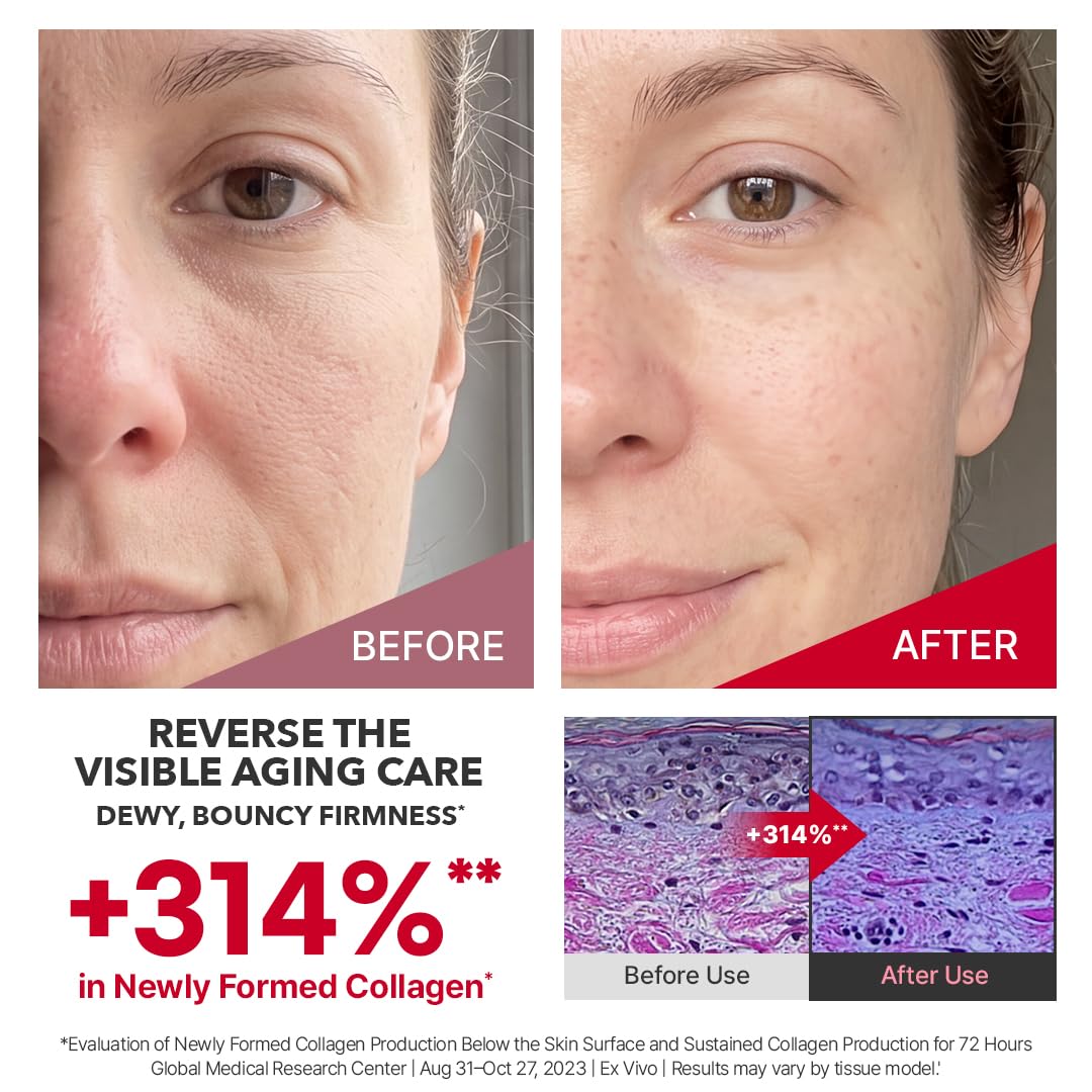 Centellian 24 Madeca Cream Time Reverse, TECA Face Moisturiser - view 3