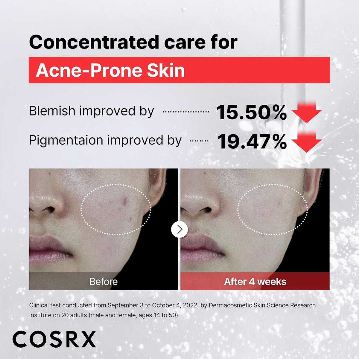 COSRX The Niacinamide 15 Serum 20ml - view 3