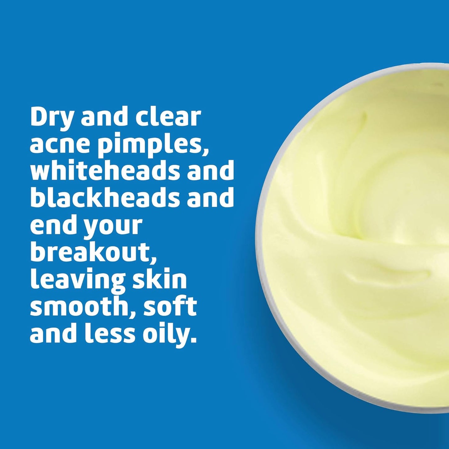 De La Cruz, Acne Treatment Ointment with 10% Sulfur, Maximum Strength, 5.5 oz