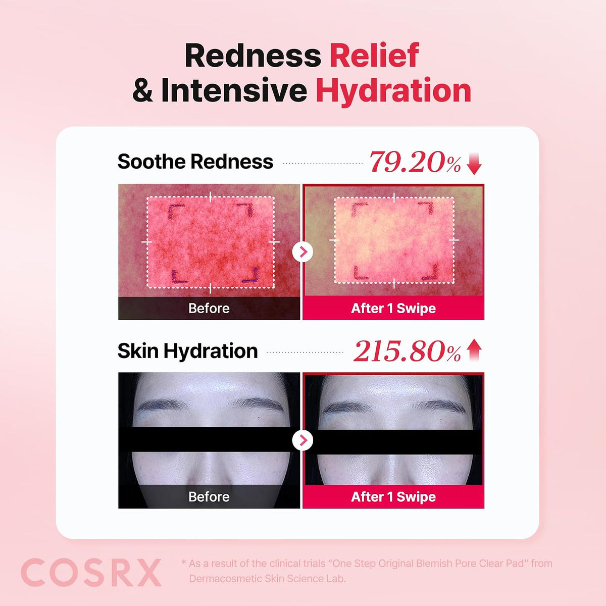 COSRX One Step Original Blemish Pore Clear Pad, 100 Pads - view 4