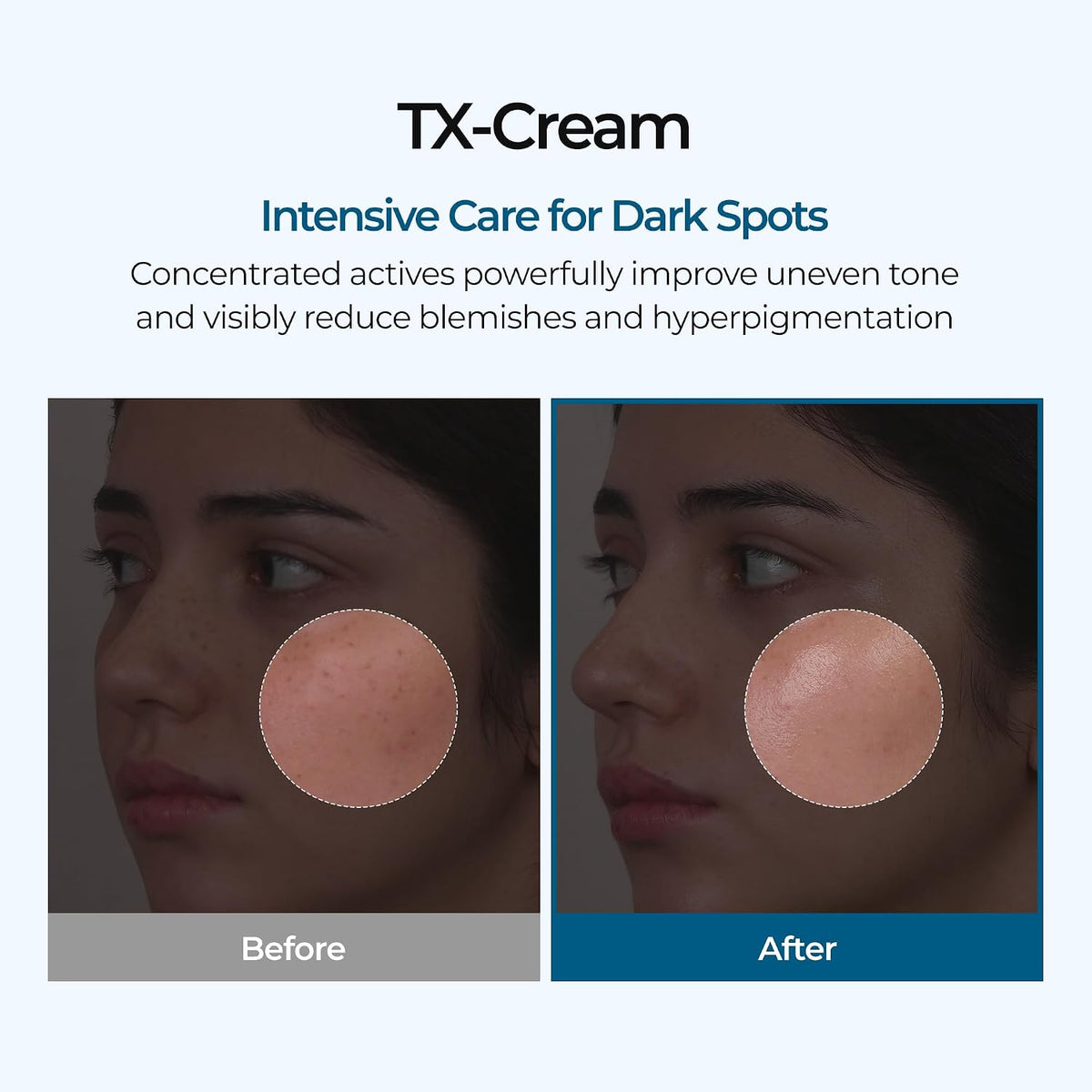 Dr.Melaxin Tx Tranexamic Acid Cream, 50 ml (1.69 fl oz) — alternate product view