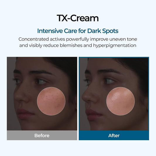 Dr.Melaxin Tx Tranexamic Acid Cream, 50 ml (1.69 fl oz) - view 2