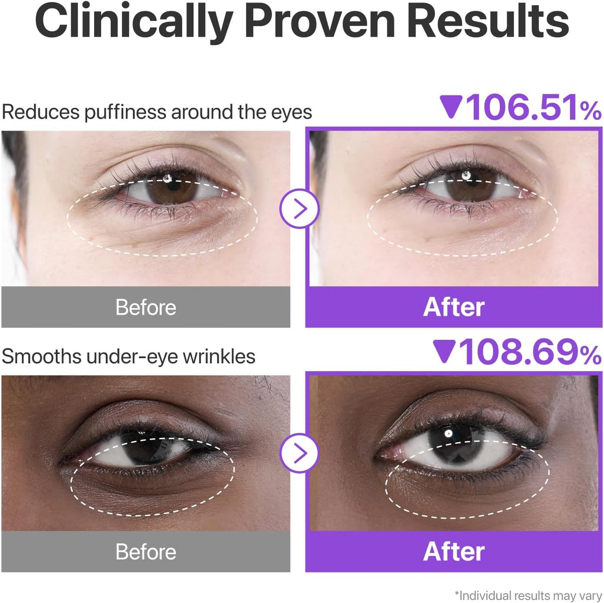 Numbuzin No.9 NAD+ & Collagen Hydrogel Under Eye Patches, 10 Patches - view 3