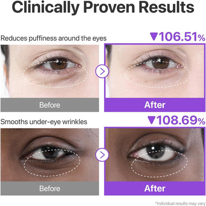 Numbuzin No.9 NAD+ & Collagen Hydrogel Under Eye Patches, 10 Patches - view 3