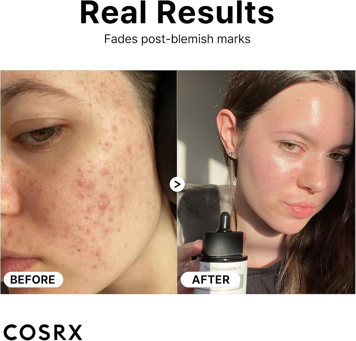 COSRX The Niacinamide 15 Serum 20ml - view 6