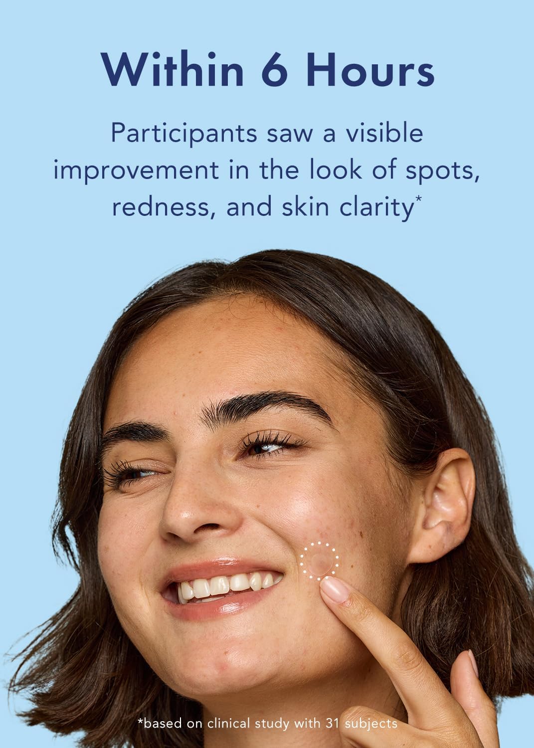 Rael Miracle Retinol Spot Cover Pimple Patches, 72 Count, Pack of 2 - view 2