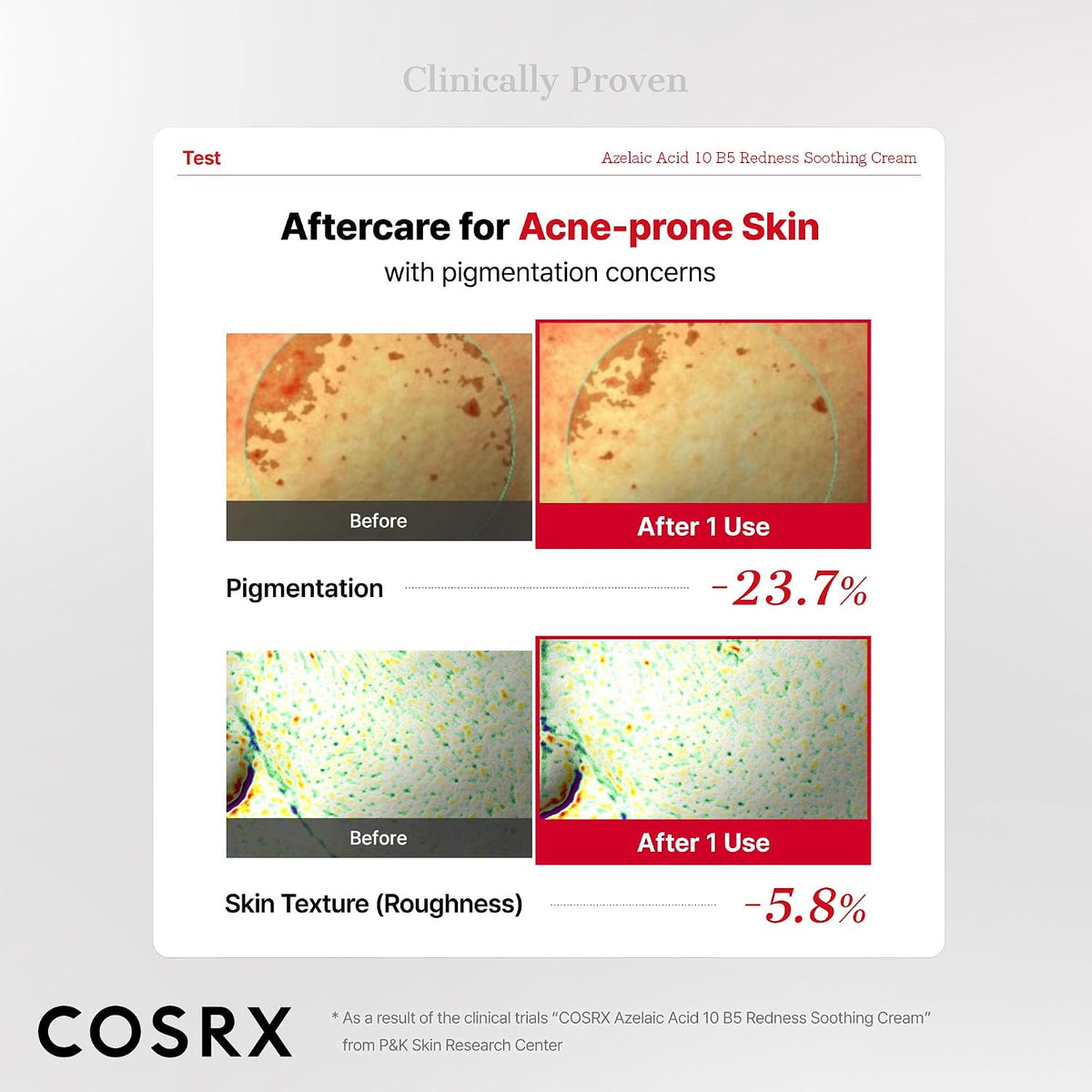 COSRX Azelaic Acid 10% B5 Redness Soothing Cream 30 ml - view 6