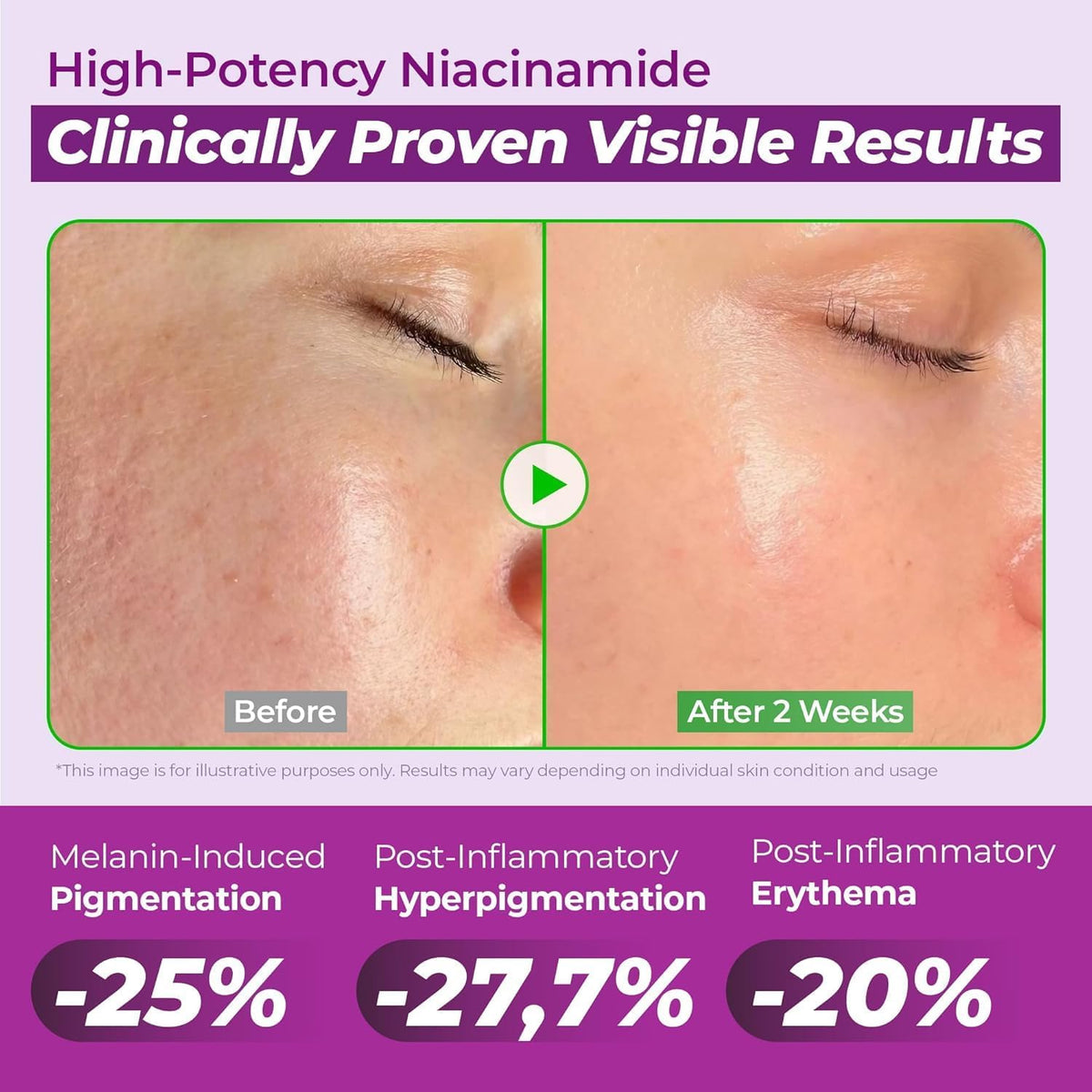 Jumiso Niacinamide Serum 20 with Glutathione and Tranexamic Acid - view 6