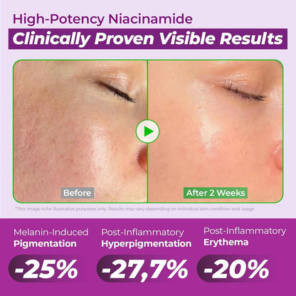 Jumiso Niacinamide Serum 20 with Glutathione and Tranexamic Acid - view 6