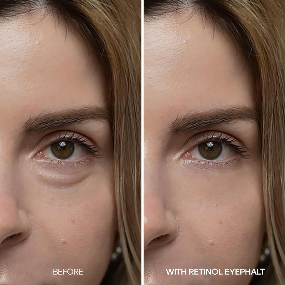 Dr.Melaxin Retinol Eyebag Cream 0.35 fl oz - view 4