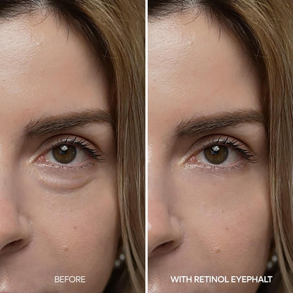 Dr.Melaxin Retinol Eyebag Cream 0.35 fl oz - view 4