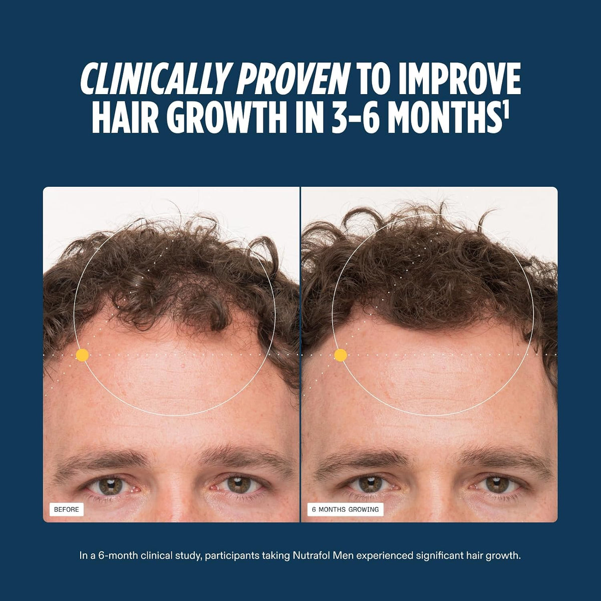 Nutrafol Men Hair Growth Supplement, Ages 18-49, 1-Month Supply - view 4