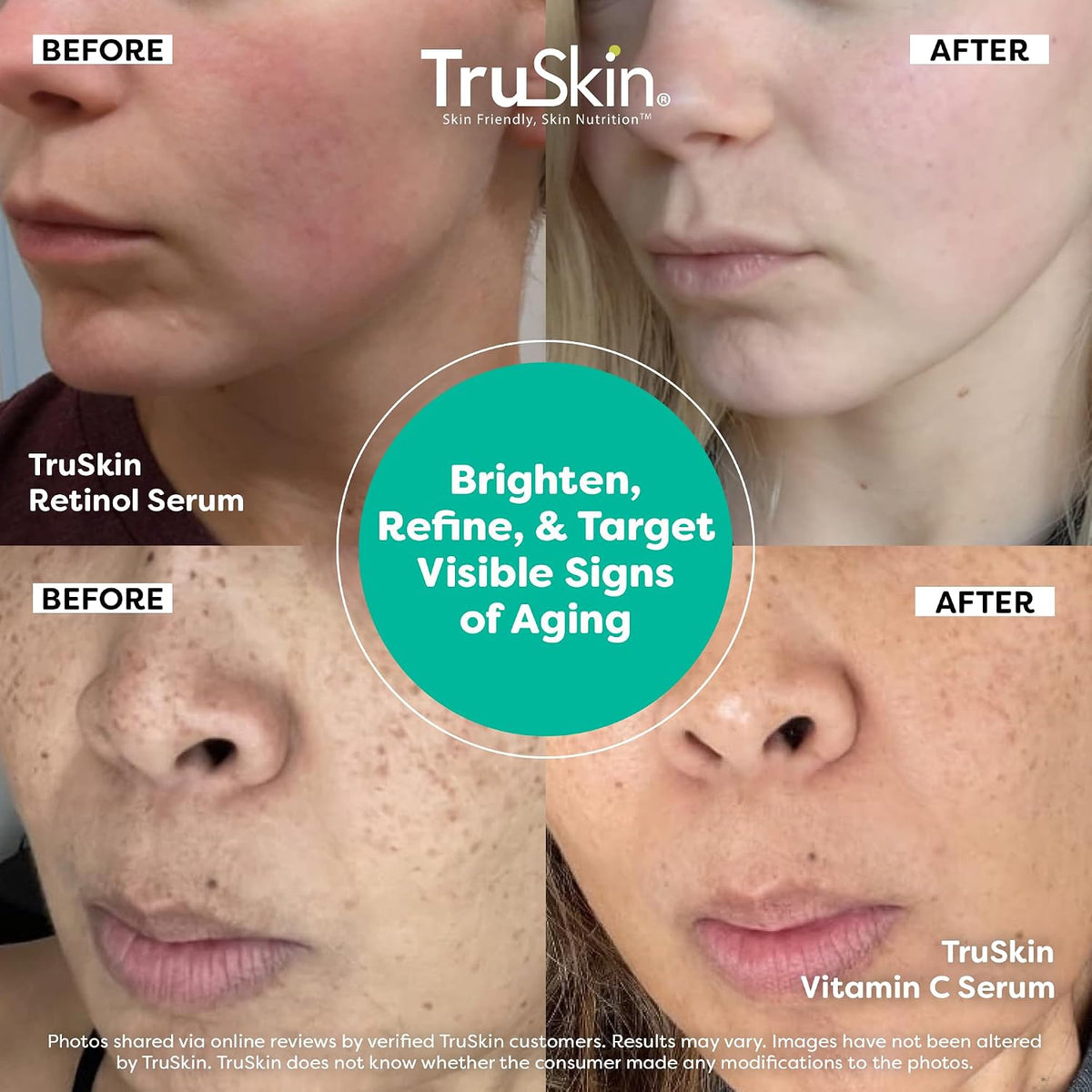 TruSkin Vitamin C Serum & Retinol Serum Duo, 2 × 30 ml (1 fl oz) - view 4
