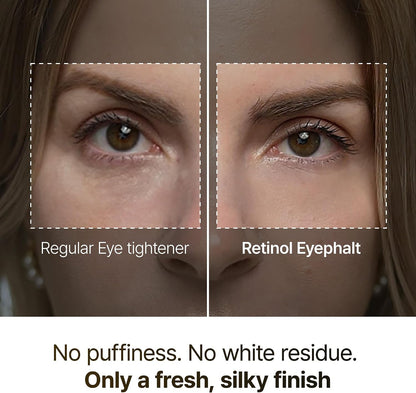 Dr.Melaxin Retinol Eyebag Cream 0.35 fl oz - view 3