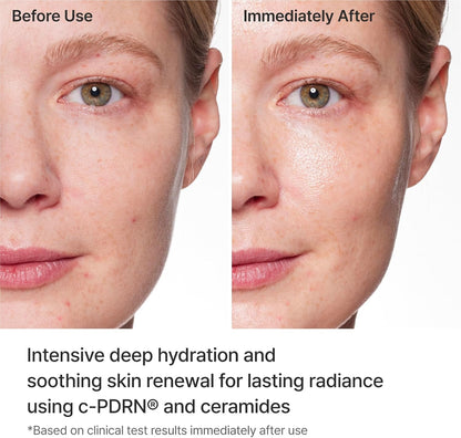 Rejuran Turnover Mask with Salmon DNA PDRN, 5 Sheet Masks - view 4