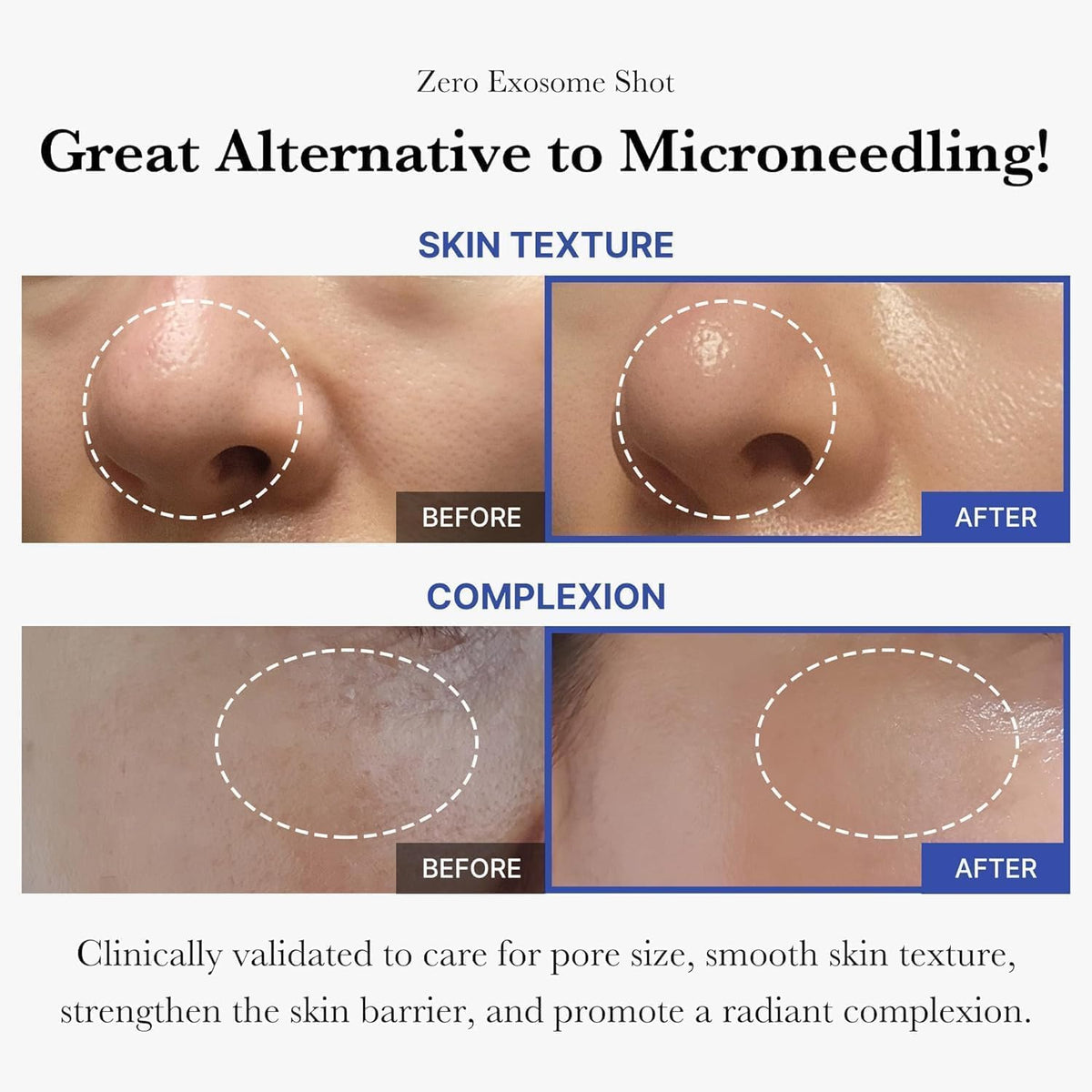 Medicube Exosome Shot Zero 2,000 PPM Spicule Facial Serum - view 3