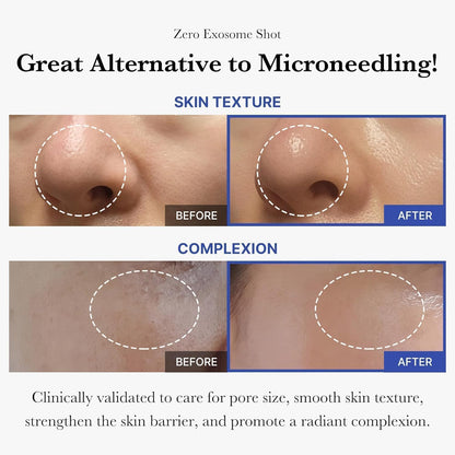 Medicube Exosome Shot Zero 2,000 PPM Spicule Facial Serum - view 3