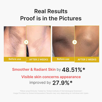 medicube Kojic Acid Turmeric Body Peel Shot, Brightening Exfoliator - view 5