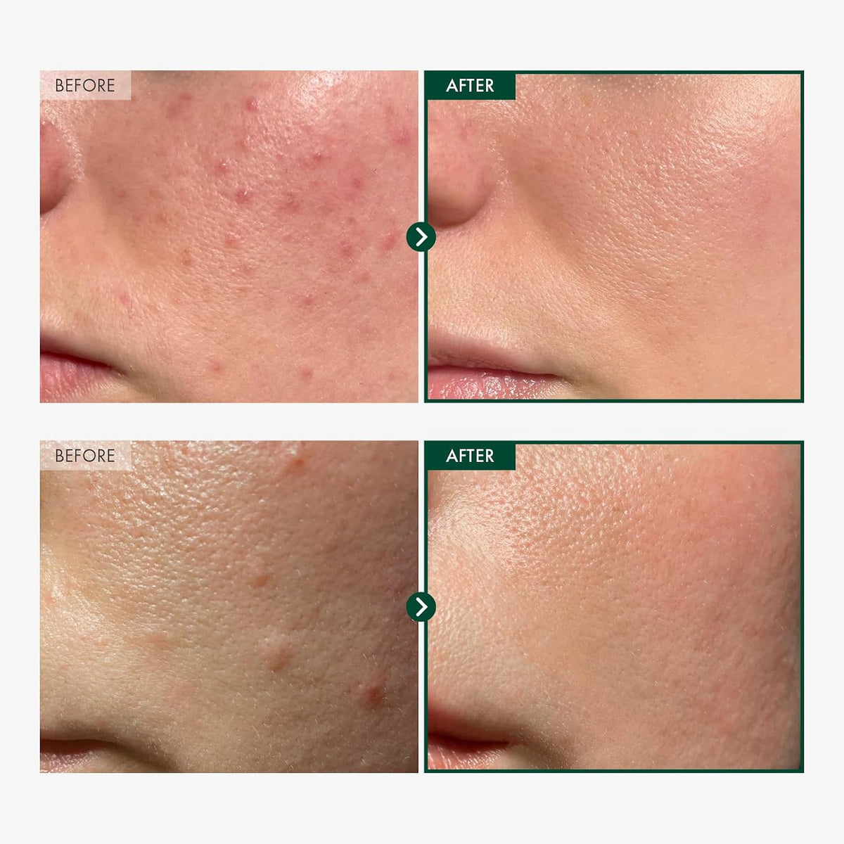 TOSOWOONG Madagascar Centella 86% Cica Ampoule — alternate product view