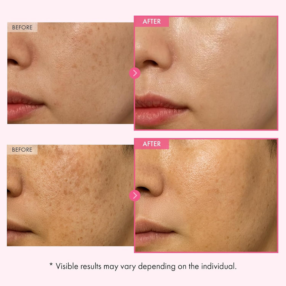 TOSOWOONG Arbutin 7% Glutathione Cream - view 4