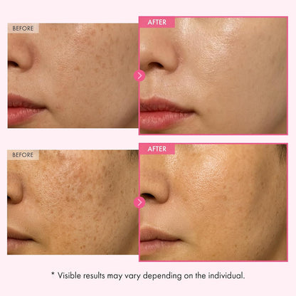 TOSOWOONG Arbutin 7% Glutathione Cream - view 4