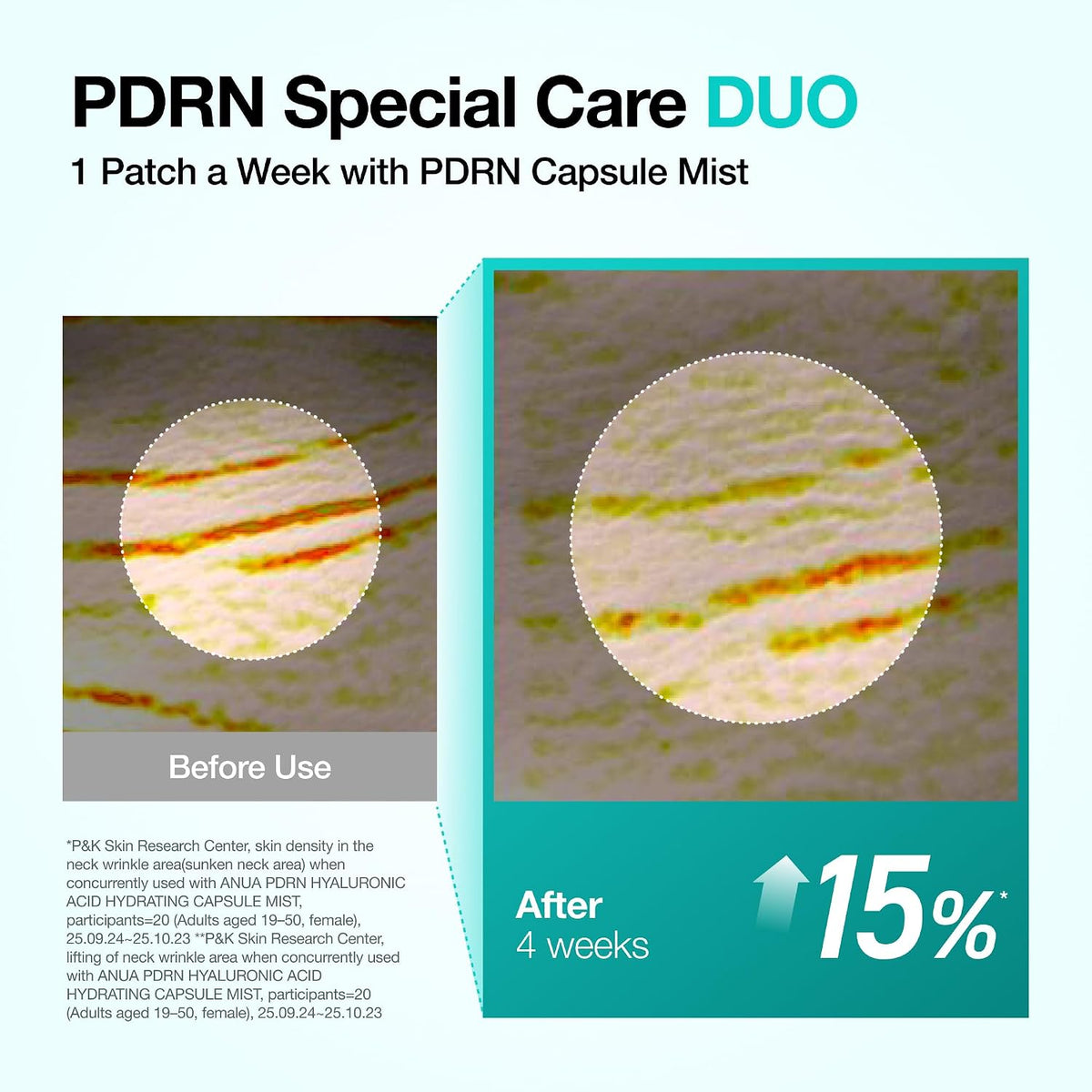 Anua PDRN Collagen Melting Patch for Neck, 4 Patches - view 4