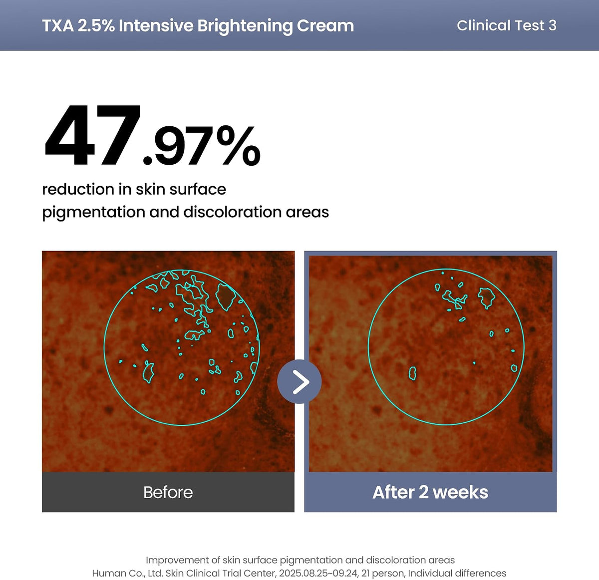 AXIS-Y TXA 2.5% Intensive Brightening Cream 50 ml (1.69 fl oz) - view 6