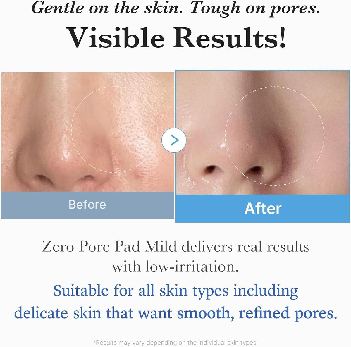 medicube Zero Pore Pad Mild 2.0 Gentle Exfoliating Toner Pads - view 5