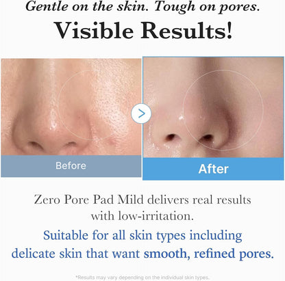 medicube Zero Pore Pad Mild 2.0 Gentle Exfoliating Toner Pads - view 5