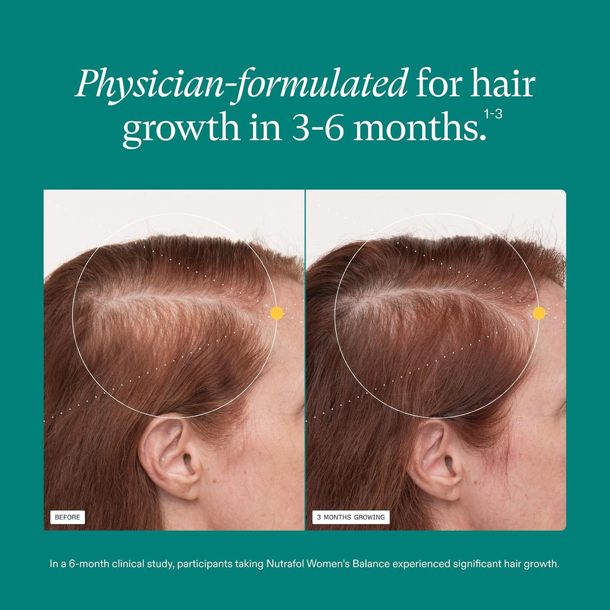 Nutrafol Women's Balance Hair Supplement, Age 45+, 1-Month Bottle - view 4