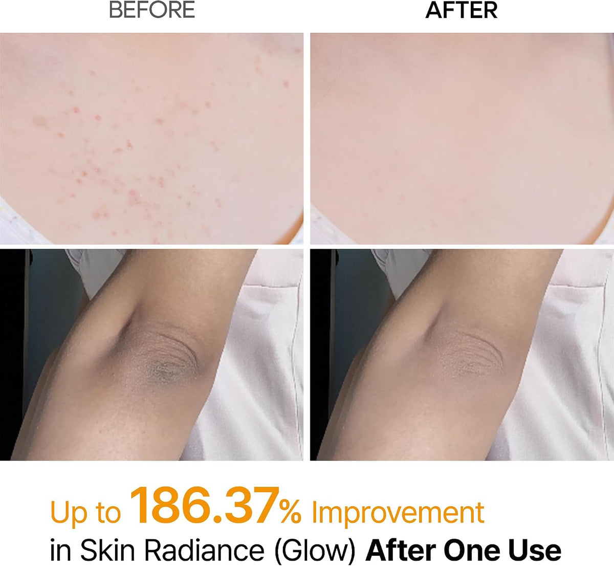 Dr.Melaxin Body Keratin Care Kojic Acid Turmeric Spray, 200 ml - view 3