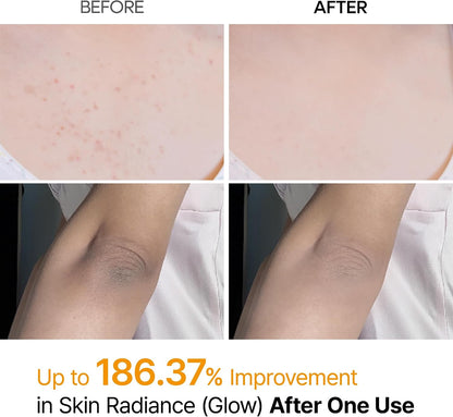 Dr.Melaxin Body Keratin Care Kojic Acid Turmeric Spray, 200 ml - view 3