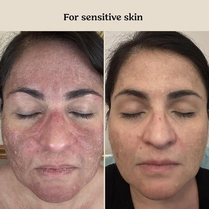 Roe Wellness Baby Cream and Baby Serum Power Pair - view 4